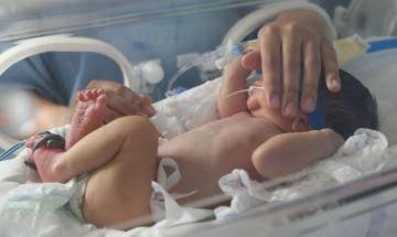 Bebês são internados depois de tomarem vacina da covid, ao invés da pentavalente
